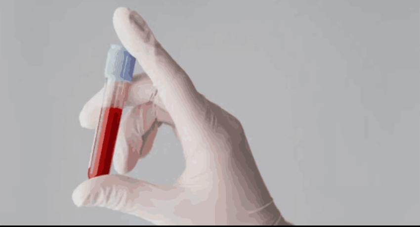 Simple blood test can prevent thalassaemia births, health authorities urge