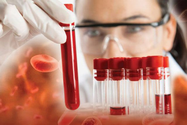 Sri Lanka Detects 45 to 60 New Thalassemia Cases Among Children Annually